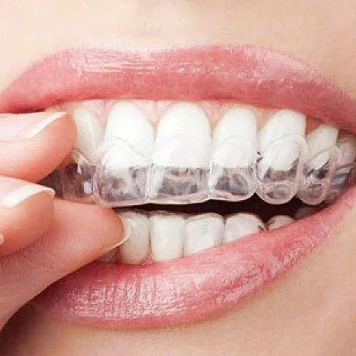 How To Maintain Your New Invisalign For A Lifetime